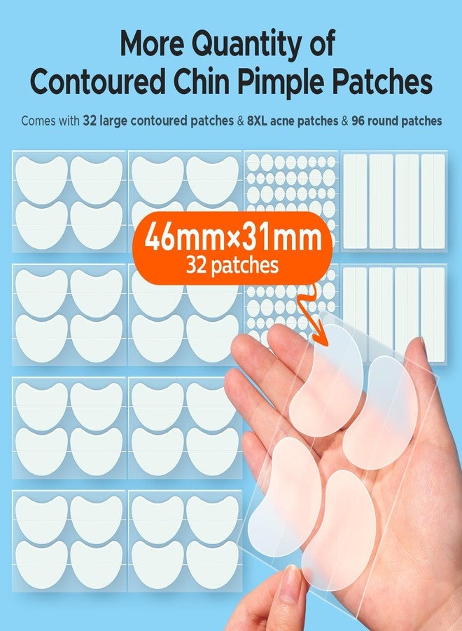 تي كيه تي كيه لصقات هيدروكولويد كبيرة الحجم لعلاج حب الشباب في منطقة الذقن والوجه، لصقة حب الشباب كبيرة الحجم محددة الشكل لمنطقة الفك، شرائط تنظيف المسام للجبهة، ملصقات نقاط لعلاج الشوائب لجميع أنواع البشرة (136 قطعة، 5 أحجام) - Image 2